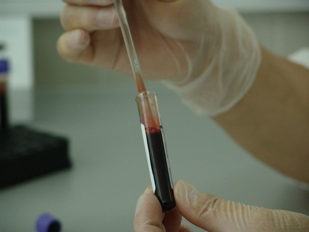 Blutplasma-Spender für Serumtherapie gesucht post's picture