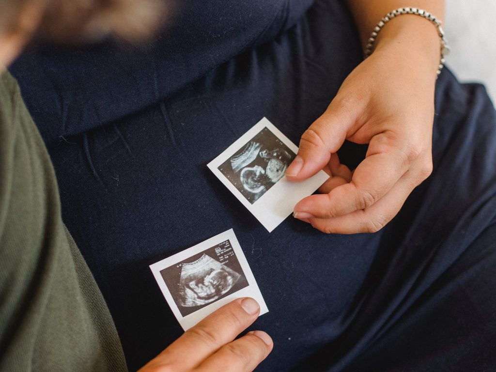 Ungarische NGOs unterstützen die neu eingeführte Herzschlag-Verordnung zum Schwangerschaftsabbruch post's picture