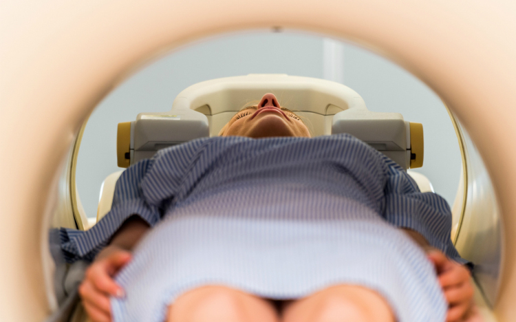 Szegediner Forscher finden die Ursache der Müdigkeit nach einer Strahlentherapie post's picture